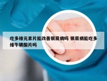 吃多维元素片能改善银屑病吗 银屑病能吃多维牛磺酸片吗