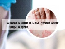 六岁孩子后背有几块小白点 6岁孩子后背有一块硬币大的白斑