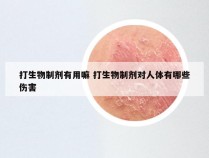 打生物制剂有用嘛 打生物制剂对人体有哪些伤害