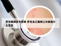 梦见胳膊长牛皮癣 梦见自己胳膊上长癣是什么意思