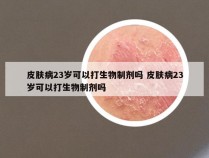 皮肤病23岁可以打生物制剂吗 皮肤病23岁可以打生物制剂吗