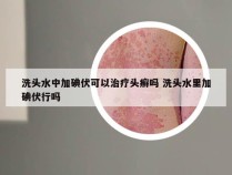 洗头水中加碘伏可以治疗头癣吗 洗头水里加碘伏行吗