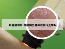 银屑病潜血 银屑病患者血液指标正常吗