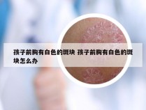 孩子前胸有白色的斑块 孩子前胸有白色的斑块怎么办