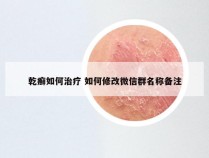 乾癣如何治疗 如何修改微信群名称备注