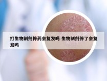 打生物制剂停药会复发吗 生物制剂停了会复发吗