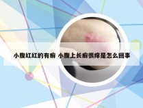 小腹红红的有癣 小腹上长癣很痒是怎么回事