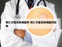 铜仁华医皮肤病医院 铜仁华医皮肤病医院招聘