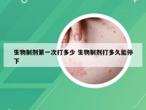 生物制剂第一次打多少 生物制剂打多久能停下