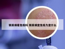 银屑病看免疫科 银屑病查免疫力查什么