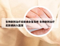 生物制剂治疗皮肤病会复发吧 生物制剂治疗皮肤病纳入医保