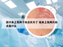 孩子身上有两个白点长大了 娃身上有两片白点是什么