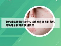 奥玛珠生物制剂治疗皮肤病对身体有伤害吗 奥马珠单抗对皮肤划痕症