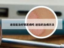 迷信能治好银屑病吗 迷信的治病方法