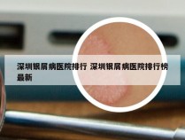 深圳银屑病医院排行 深圳银屑病医院排行榜最新