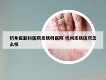 杭州皮肤科医院皮肤科医院 杭州皮肤医院怎么样