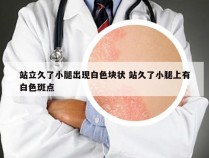 站立久了小腿出现白色块状 站久了小腿上有白色斑点