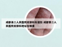 成都弟二人民医院皮肤科石道街 成都第二人民医院皮肤科地址在哪里