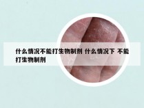 什么情况不能打生物制剂 什么情况下 不能打生物制剂