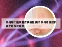 泰州哪个医院看皮肤病比较好 泰州看皮肤科哪个医院比较好