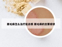 腋毛癣怎么治疗能去根 腋毛癣的主要症状