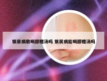 银屑病敢喝醪糟汤吗 银屑病能喝醪糟汤吗