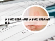 关节病型银屑病的原因 关节病型银屑病的原因是