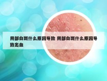 阴部白斑什么原因导致 阴部白斑什么原因导致出血