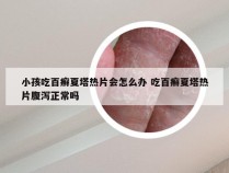 小孩吃百癣夏塔热片会怎么办 吃百癣夏塔热片腹泻正常吗