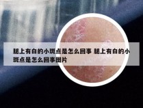 腿上有白的小斑点是怎么回事 腿上有白的小斑点是怎么回事图片