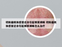 切除扁桃体感冒还会引起银屑病嘛 切除扁桃体感冒还会引起银屑病嘛怎么治疗