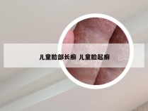 儿童脸部长癣 儿童脸起癣