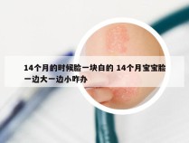 14个月的时候脸一块白的 14个月宝宝脸一边大一边小咋办