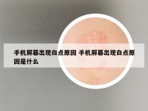 手机屏幕出现白点原因 手机屏幕出现白点原因是什么