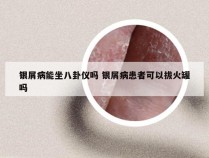 银屑病能坐八卦仪吗 银屑病患者可以拔火罐吗