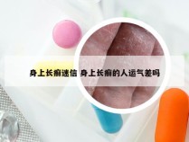 身上长癣迷信 身上长癣的人运气差吗