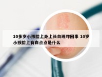 10多岁小孩脸上身上长白班咋回事 10岁小孩脸上有白点点是什么