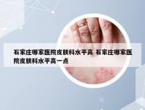 石家庄哪家医院皮肤科水平高 石家庄哪家医院皮肤科水平高一点