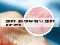 左侧腋下十厘米皮肤有白斑是什么 左侧腋下10公分处疼痛