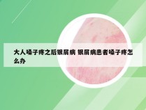 大人嗓子疼之后银屑病 银屑病患者嗓子疼怎么办