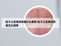 肚子上出现白斑是什么原因 肚子上出现白斑是怎么回事