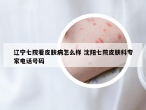 辽宁七院看皮肤病怎么样 沈阳七院皮肤科专家电话号码