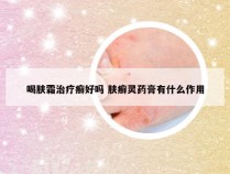 喝肤霜治疗癣好吗 肤癣灵药膏有什么作用