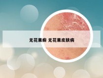 无花果癣 无花果皮肤病