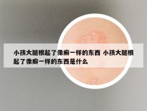 小孩大腿根起了像癣一样的东西 小孩大腿根起了像癣一样的东西是什么