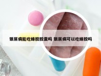 银屑病能吃蜂胶胶囊吗 银屑病可以吃蜂胶吗