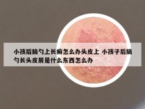 小孩后脑勺上长癣怎么办头皮上 小孩子后脑勺长头皮屑是什么东西怎么办