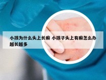 小孩为什么头上长癣 小孩子头上有癣怎么办越长越多