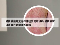 银屑病使用复方咪康唑乳膏可以吗 银屑病可以用复方克霉唑乳膏吗