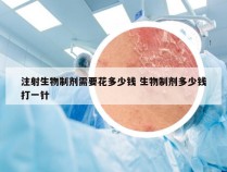 注射生物制剂需要花多少钱 生物制剂多少钱打一针